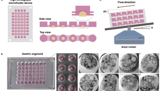 cell culture with tissue ecm in a microfluidic chip