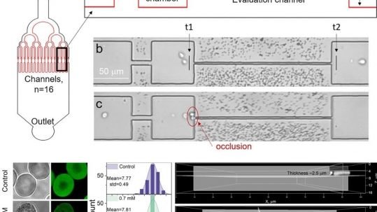 microfluidic device for red blood cell analysis